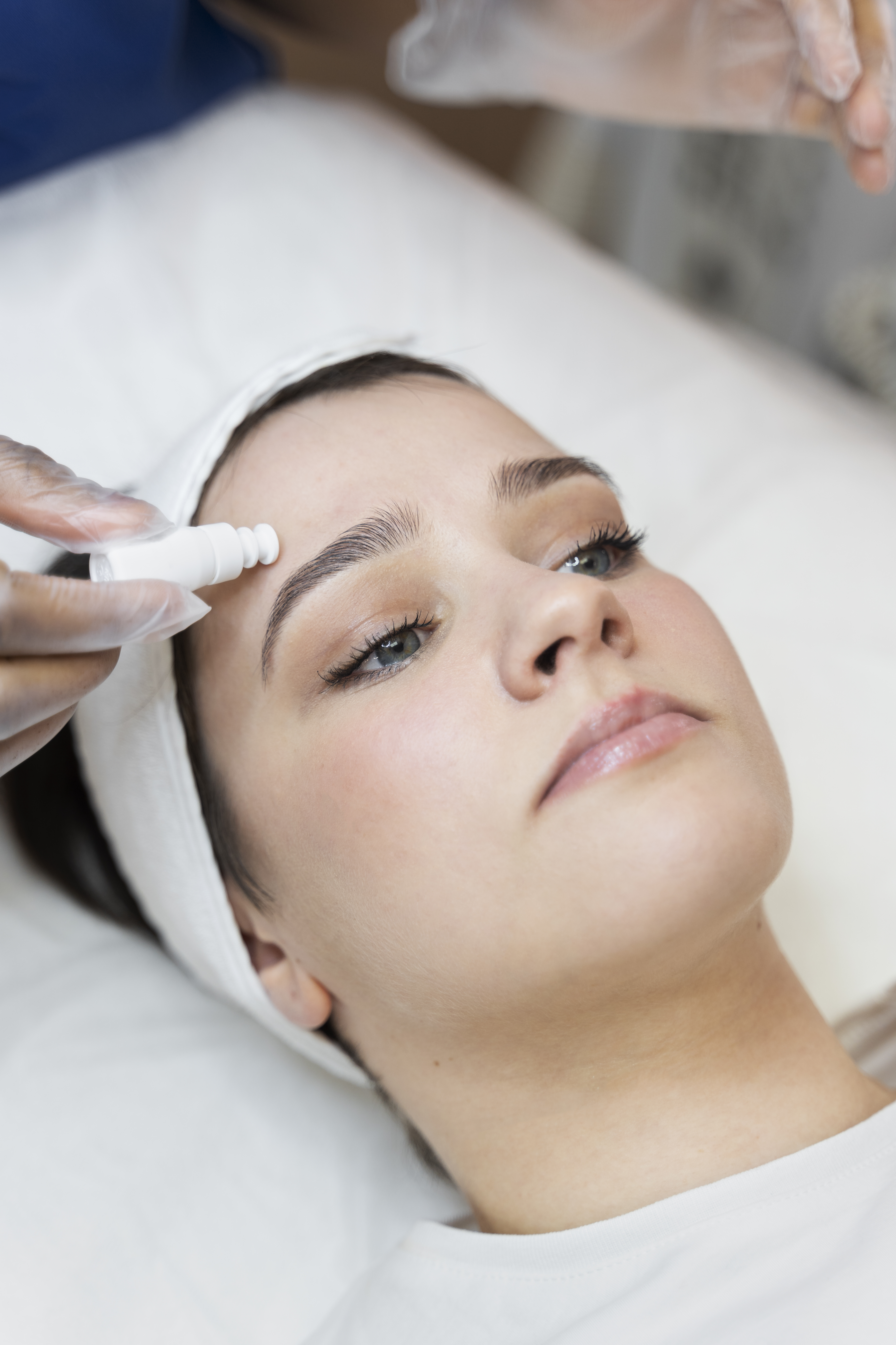 person-getting-micro-needling-beauty-treatment